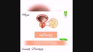 پروستات