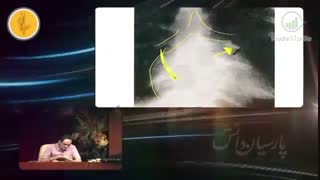 نمونه تدریس رادیولوژی توسط دکتر میثم شفیعی مطهر متخصص رادیولوژی لیزر موهای زائد