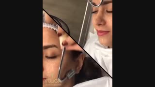 هیدرادرمی و پاکسازی پوست