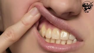 نسخه های طبیعی طب سنتی برای سفید کردن دندان