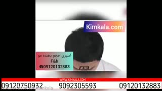 اسپری تقویت موی F&h | بهترین راه تقویت موی سر | خرید اسپری مو| اسپری پرپشت کننده مو | 09120750932