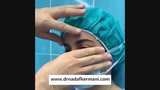 فیلم لیفت ابرو