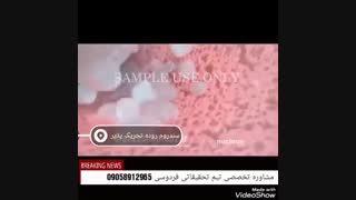 علائم سندروم روده تحریک پذیر چیست یا درمان دارد؟