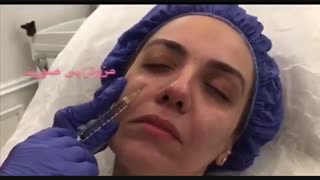 خدمات کلینیک زیبایی گلدن رویال