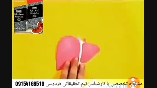 درمان کبد چرب و راه های  پاکسازی کبد چیست؟