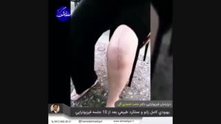 قیمت فیزیوتراپی در منزل تهران، 09128332821