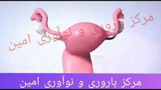 درمان ناباروری با ivf