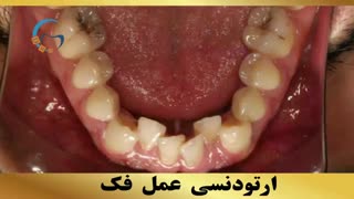 متخصص ارتودنسی | دکتر داودیان