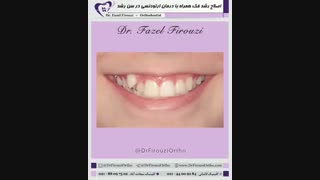 اصلاح رشد فکی | دکتر فیروزی
