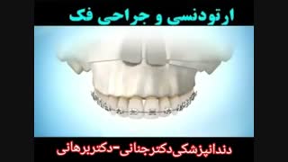 ارتودنسی و جراحی فک