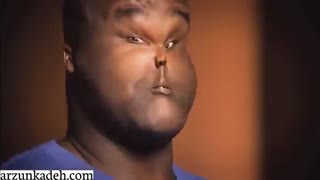 کرم ضد آفتاب آکنه