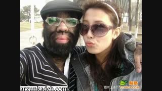 اپیلاسیون کامل آقایان