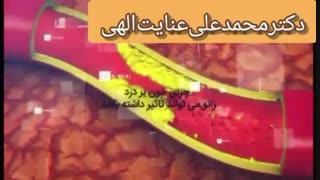 باورهای غلط درد زانو