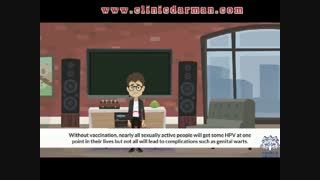 زگیل تناسلی یا زگیل مقاربتی