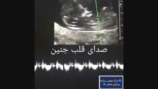 صدای قلب جنین | مرکز تصویربرداری پزشکی نماطب
