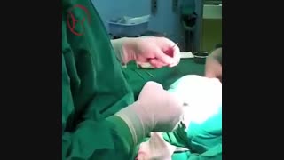 جراح زیبایی پلک