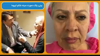 جراحی لیفتینگ صورت