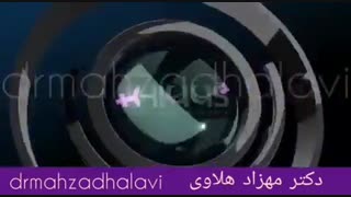 فواید هیگز برای بانوان