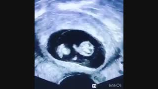 حرکت جنین در رحم مادر در طی ده هفته | مرکز تصویربرداری پزشکی نماطب