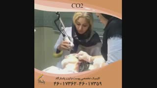 فیلم لیزر CO2