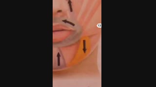بوتاکس صورت و لب دکتر ابراهیممقیمی