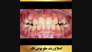 ارتودنسی تهران | دکتر داوودیان