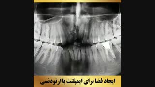 دکتر داودیان | متخصص ارتودنسی