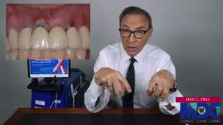 التهابات اطراف ایمپلنت