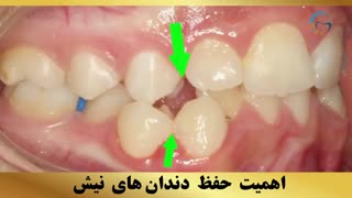 دکتر ارتودنسی | دکتر داوودیان