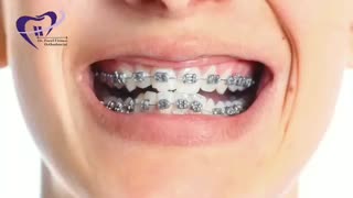 روش پیزوسیژن | دکتر فاضل فیروزی