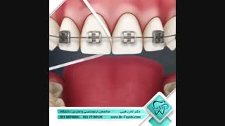 نحوه استفاده از نخ دندان | دکتر لادن طیبی