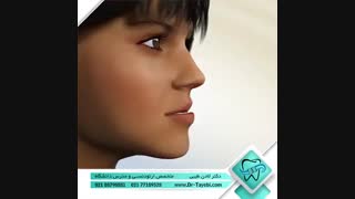 درمان جلو بودن فک پایین | دکتر طیبی