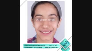 درمان ارتودنسی | دکتر لادن طیبی