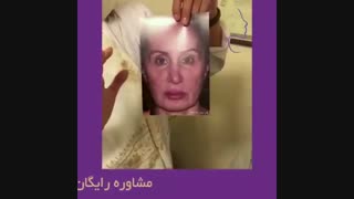جراحی ترمیمی بینی
