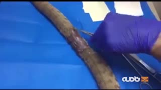 بخیه زدن مار افعی گرزه زخمی به‌عنوان بزرگترین افعی ایران