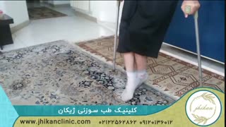 درمان فلج اطفال پس از بیست و هفت سال به کمک طب سوزنی|کلینیک ژیکان