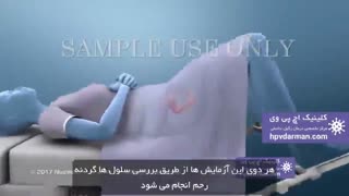 ویروس پاپیلومای انسانی (HPV) و سرطان رحم (https://hpvdarman.com/)