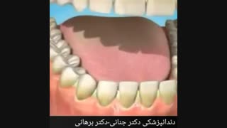 تاثیر استعمال دخانیات بر روی دندان