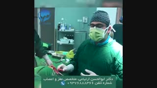 فیلم جراحی کالوزوتومی بیمار با تشنج مکرر
