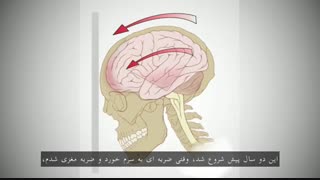 تد تاک مک گونیگال