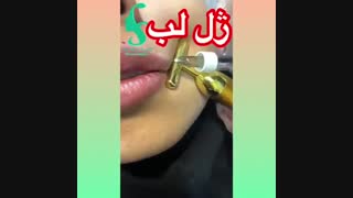 فیلم تزریق ژل لب ترمیم لبخند لثه‌ای