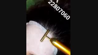 مزوتراپی - 22807060