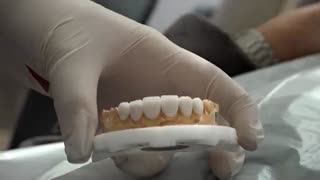 افضل عیادة اسنان ابتسامة هولیود فی ایران | سعر قشرة الاسنان التجمیلیة