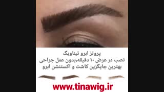 پروتز ترمیم ابروی تیناویگ ( ابرو مصنوعی ) بهترین جایگزین کاشت و اکستنشن و تاتو ابرو
