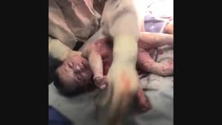 فیلم عمل زایمان سزارین