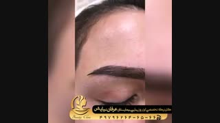 کاشت ابرو خوبه؟
