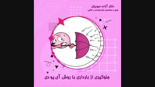 جلوگیری از بارداری به روش آی یو دی