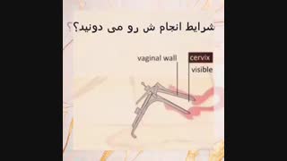 تست پاپ اسمیر