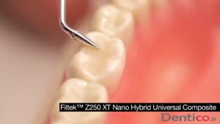 کامپوزیت 3M - Filtek Z250 Universal