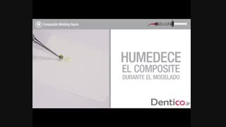 کامپوزیت وتینگ رزین Wetting Resin کمپانی اولترادنت